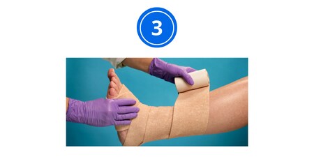 the carer applies a bandage to the leg
