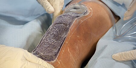 Drei Chirurgen operieren einen Patienten
