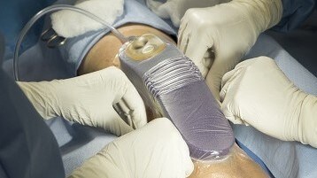 Bild eines Patienten zu Hause mit dem Prevena Dressing
