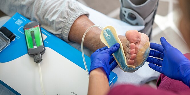 Ein Arzt wendet bei einem Patienten das Snap Therapiesystem zur Unterdruck-Wundtherapie an
