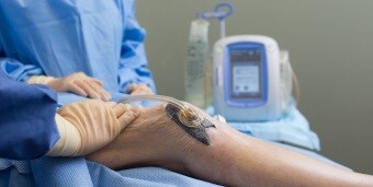 Patientenknie mit Unterdruck-Wundtherapie
