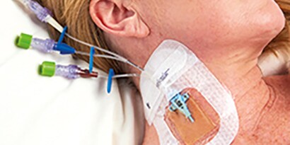 Empfehlung der KRINKO - „Prävention von Infektionen, die von Gefäßkathetern ausgehen“
