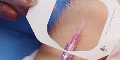 3M Transparentverband mit CHG Gelpad
