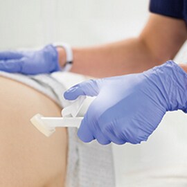 Cavilon Advanced im Gebrauch an einem Patienten