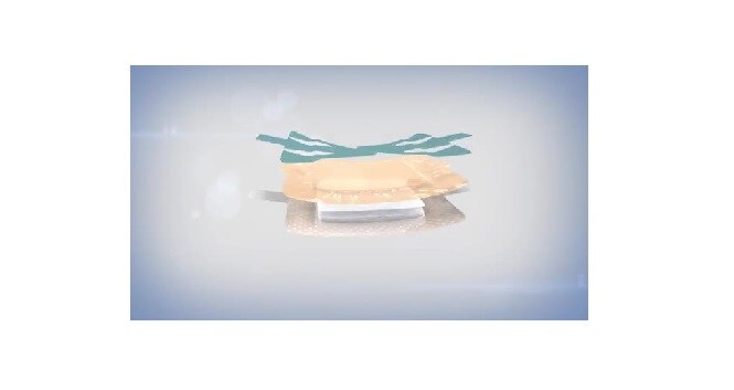 3m tegaderm foam dressing product brochure hand bandage
