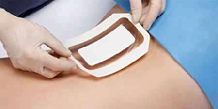 3M Tegaderm + Pad
