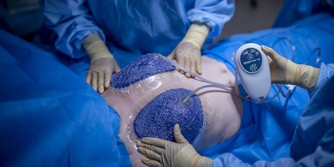 Brest surgery
