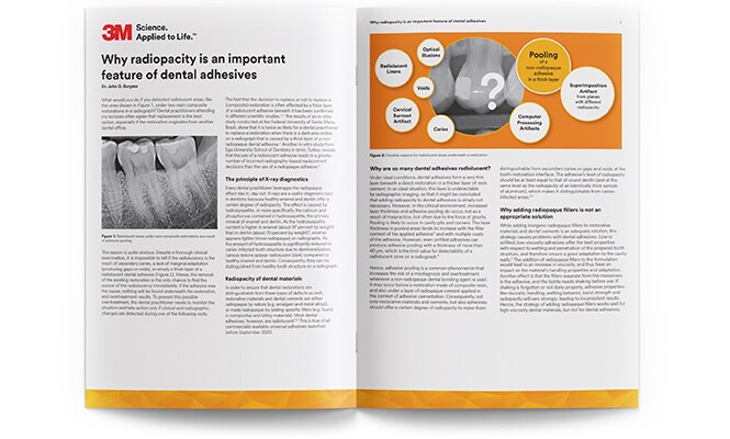 Miniaturansicht des Whitepapers über Dentalklebstoffe
