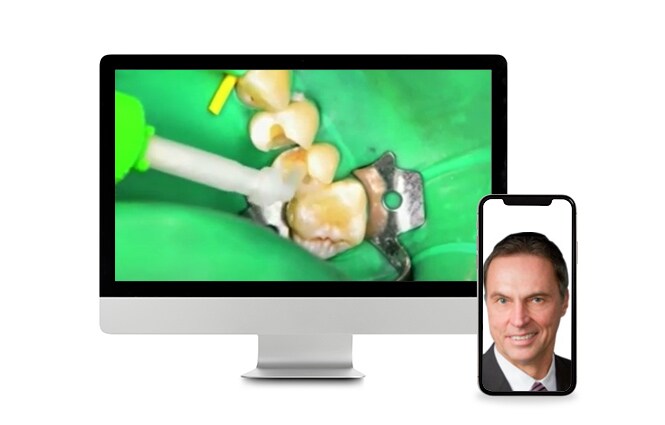 Webinar über das Zementieren und Befestigen von Zahnmaterialien
