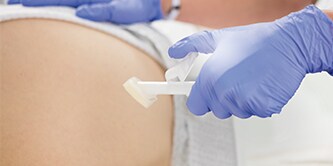 Cavilon Hochleistungsfähiger Hautschutz bei einem Patienten angewendet

