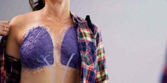 Prevena Restor™ Genesung des Weichgewebes
