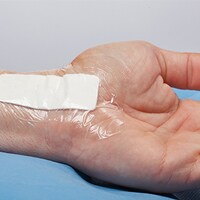 SSI Verband